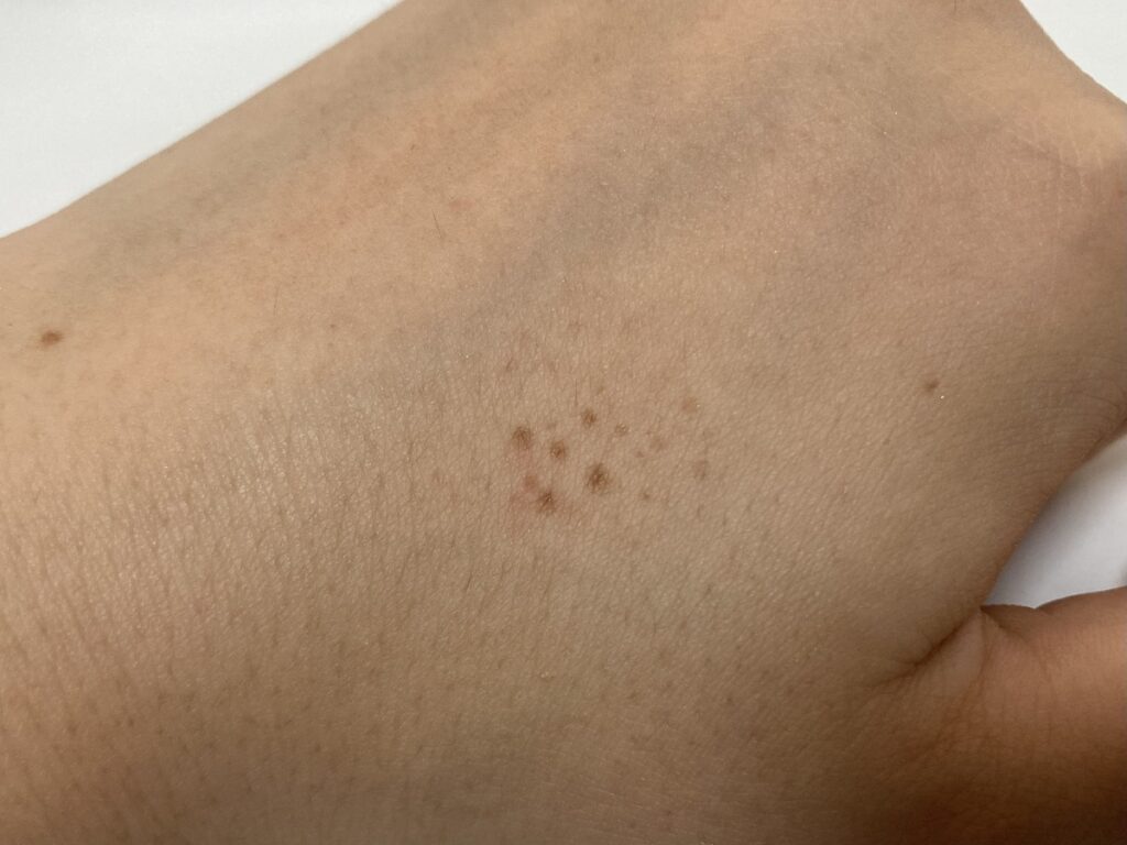 tarteのgo with the faux freckle stampのテクスチャー
